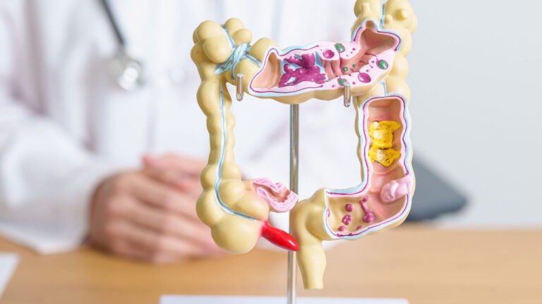 DIOPTRA launches ambitious new study